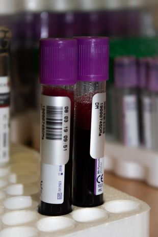 augla-rezus-faktora-tests-no-mates-asinim
