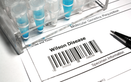 Wilson's disease