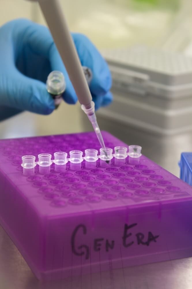 Who should undergo a celiac disease DNA test?