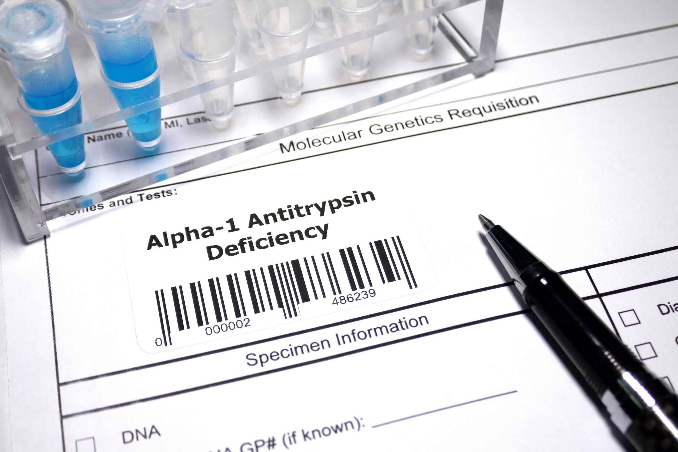 Alpha-1 antitrypsin deficiency DNA test: